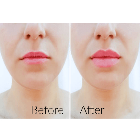 Rose Lip Plumper - MOQ 25pcs