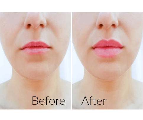 Rose Lip Plumper - MOQ 12pcs