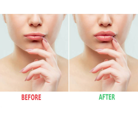 Strawberry Lip Plumper - MOQ 12pcs