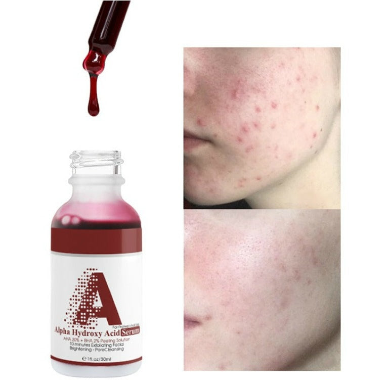 AHA 30% BHA 2% Exfoliating Facial Peel - MQO 12 pcs
