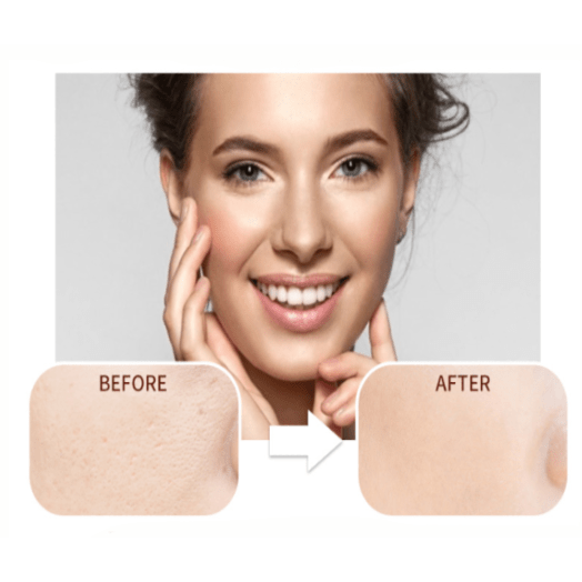 Matte My Day Face Primer - MQO 25 pcs