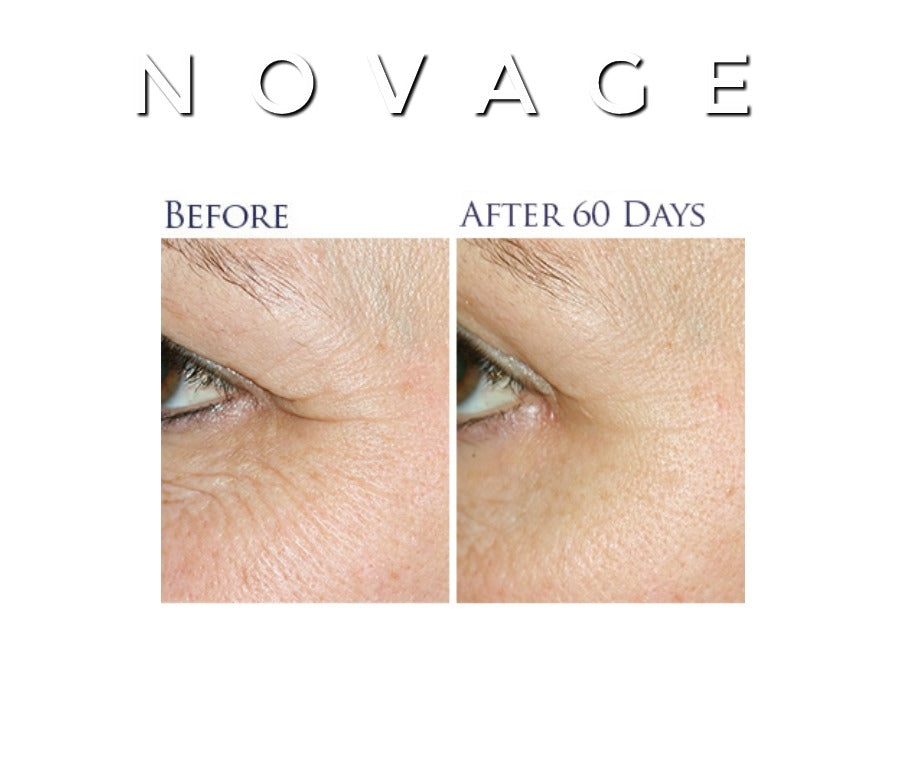 Novage Anti-Aging Cream - MQO 12 pcs