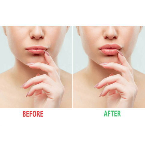 Rose Lip Plumper - MOQ 25pcs