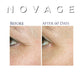 Novage Anti-Aging Cream - MQO 25 pcs